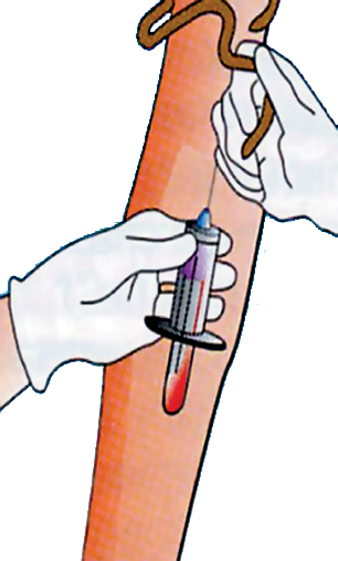 Вакуумный забор крови из вены алгоритм. Техника взятия крови вакуумной системой. Взятие крови из периферической вены с помощью вакуумной системы. Пробирки для взятие крови из периферической вены. Взятие крови из периферической вены шприцем.